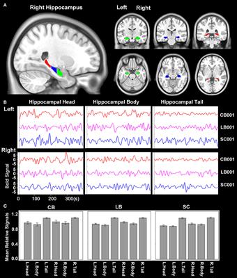 Enhanced Functional Coupling of Hippocampal Sub-regions in Congenitally and Late Blind Subjects